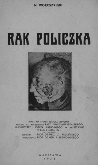 Rak policzka